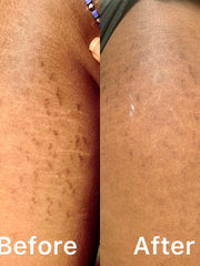 Load image into Gallery viewer, Skin healing cream