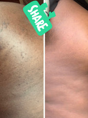 Load image into Gallery viewer, Skin healing cream