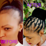 Load image into Gallery viewer, Complete hairgrowth kit
