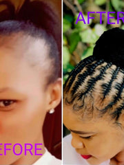 Load image into Gallery viewer, Complete hairgrowth kit
