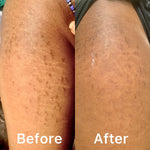 Load image into Gallery viewer, Skin healing cream
