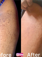 Load image into Gallery viewer, Skin healing cream
