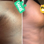 Load image into Gallery viewer, Skin healing cream
